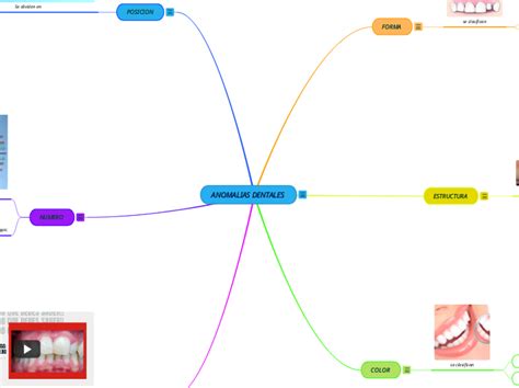Anomalias Dentales Miellekartta