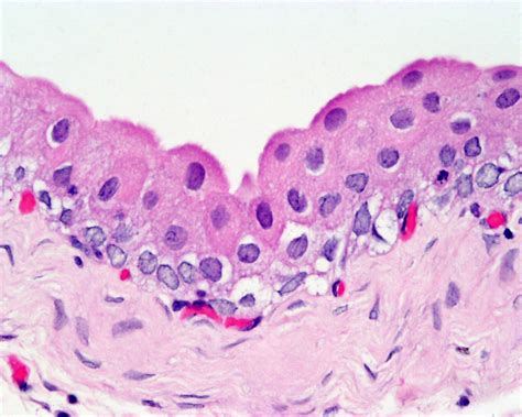 Normal Urinary Tract Bladder Histology