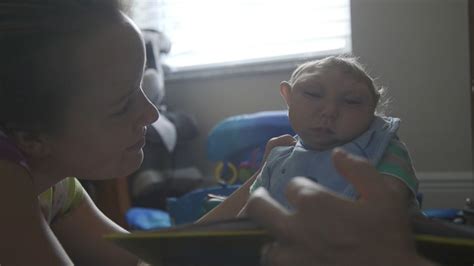 Florida Miracle Baby Born Without Most Of His Brain Beating The Odds