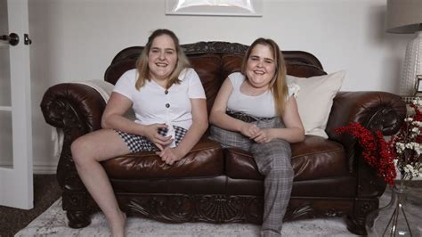 The Amazing Story Of The Connected Herrin Twins How They Look Now
