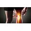 Comprehensive Overview Of Knee And Joint Pain Its Symptoms Causes 