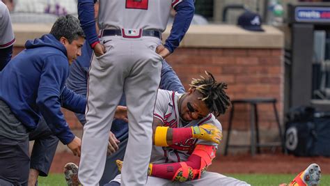 Acuña In Braves Lineup Day After Was Hit On On Shoulder