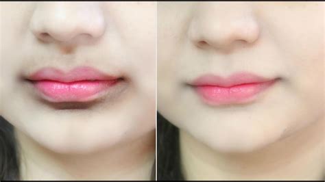 How Can I Get Rid Of Dark Circles Around My Lips Lipstutorial Org