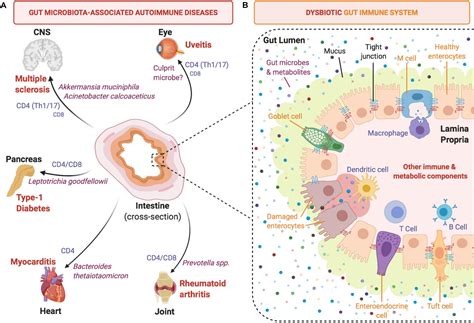 Frontiers Microbiota As Drivers And As Therapeutic Targets In Ocular