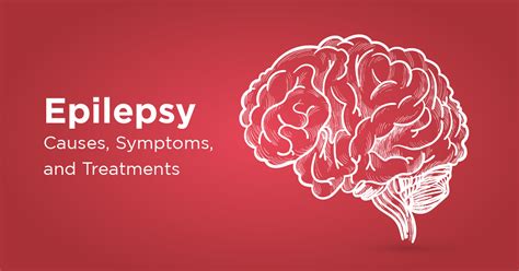 Epilepsy Causes Symptoms Diagnosis And Treatment Options