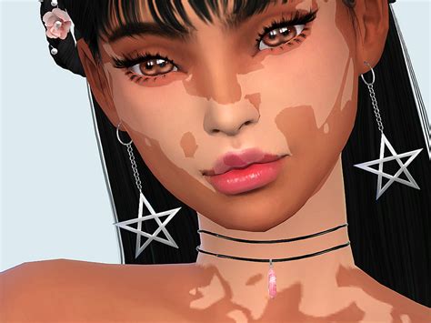Sims 4 Vitiligo The Sims 4 Create A Sim Vitiligo Beauty 💞 Youtube