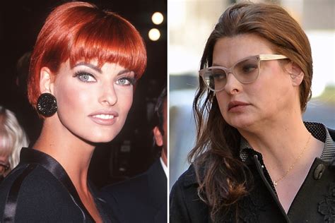 Supermodel Linda Evangelista Claims Shes Been Left Deformed And