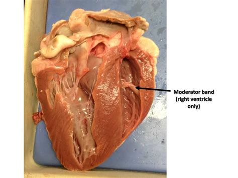 The coronary sinus is roughly a 3 cm saccular dilatation between the left cardiac chambers. PPT - Sheep Heart PowerPoint Presentation - ID:7043500