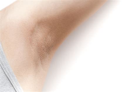 Womans Armpit With Some Hairy On White Background Isolated Stock Photo