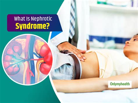 Nephrotic Syndrome Know More About This Disease Its Symptoms Causes