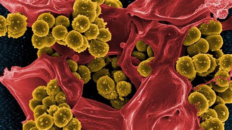 Antibiotic Resistant Superbugs Could Kill 10 Million People A Year By 2050