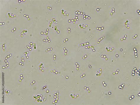 Yeast Cells Under Light Microscope Micropedia