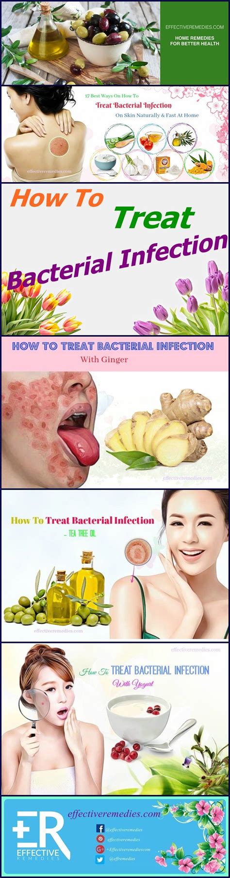 17 Best Ways To Treat Bacterial Infection On Skin Naturally And Fast At