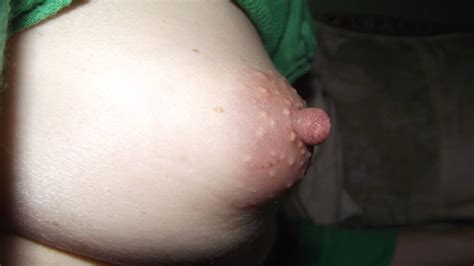 My Very Small Tits Puffy March 2016 Voyeur Web