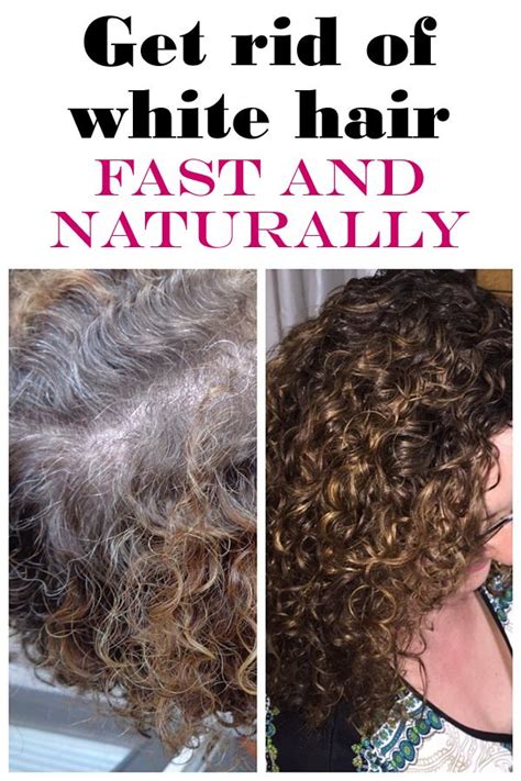 7 Ways To Get Rid Of White Hair With Images Hair Health White Hair