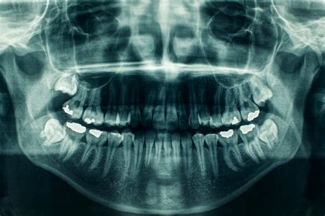 Ortopantomografía Y Tac 3d Archivos Dental Medical Group