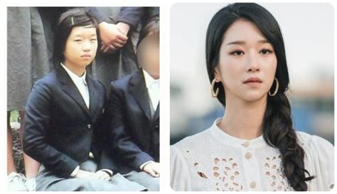 Korean Media Has Revealed The Evidence Of Seo Ye Ji Plastic Surgery