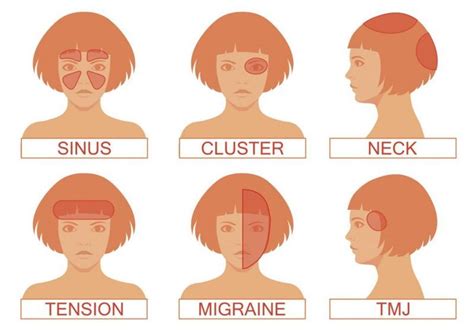 Headache Guide Different Types Of Headaches Facty Health Headache