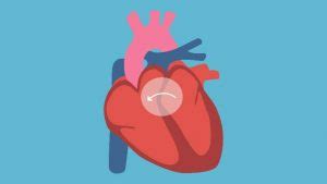 Tanda sakit jantung sebelum terlambat, kamu perlu tahu beberapa tanda jantungmu bermasalah yang seringnya disepelekan. Tanda Sakit Jantung - (Lengkap) Hati-Hati, Takut Anda ...