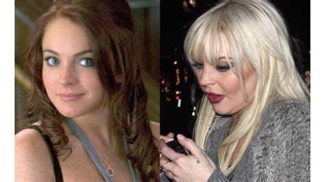 20 Worst Cases Of Celebrity Plastic Surgery Gone Wrong Page 3 Of 5