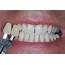 Teeth Whitening Hull  Dental Practice Manor Health