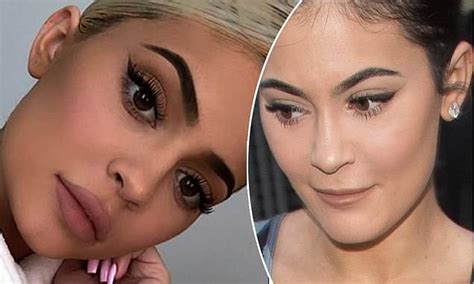 Kylie Jenner Confirms Shes Back To Getting Lip Filler Daily Mail Online