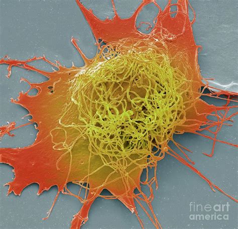 Liver Cancer Cell 2 Photograph By Steve Gschmeissnerscience Photo