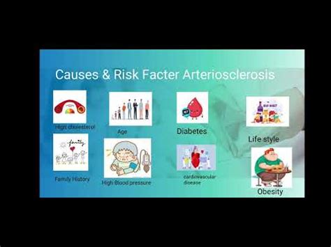 Arteriosclerosis Youtube