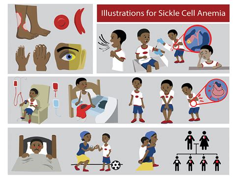 Sickle Cell Anemia Symptoms By Justine Mccorkle At Coroflot Com