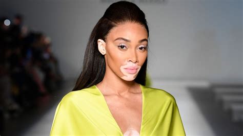 Winnie Harlow In Bathing Suit Says I Love Your Smile — Celebwell