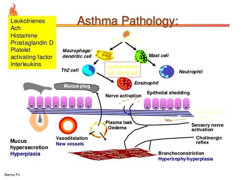 Asthma is a complex inflammatory respiratory disease caused by many inflammatory cells and mediators. Flow Chart Simple Pathophysiology Of Asthma - Asthma Lung ...