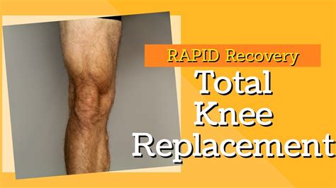 2 Key Exercises To Rapid Recovery For Total Knee Replacement YouTube