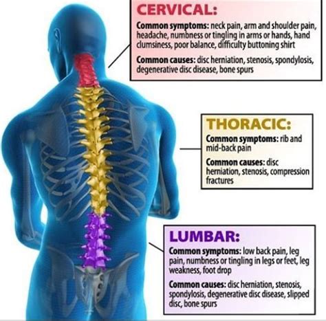 87 Awesome What Are Symptoms Of Back Problems Insectza