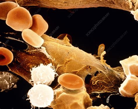 Coloured Sem Of Bone Marrow Tissue Stock Image P2340024 Science