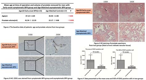 Mp Early Onset Symptomatic Bph Tissues Of Men Less Than Or Equal To Years Old Appeared