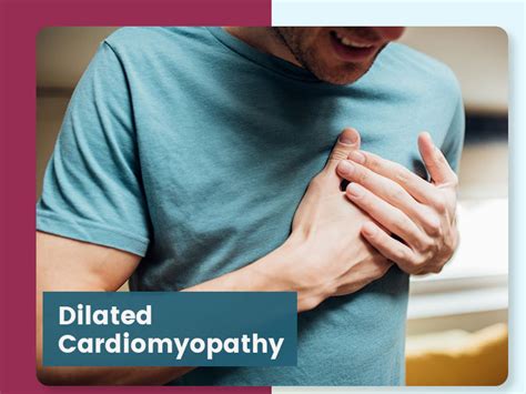 Dilated Cardiomyopathy Causes Complication And Prevention Tips