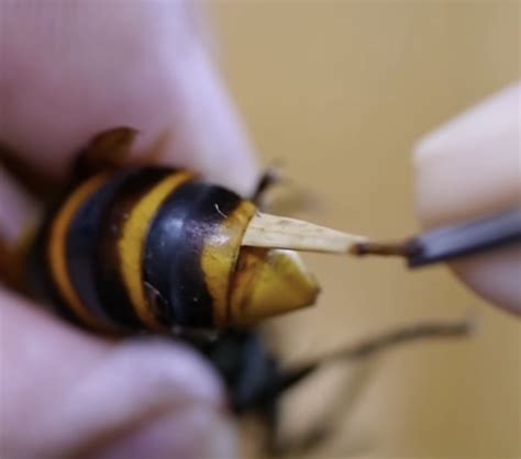 Man Shows How He Removes A Giant Parasite From Inside Of A Hornet