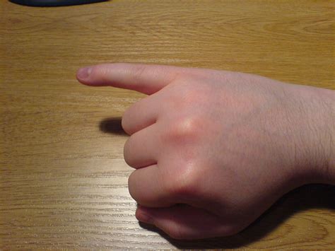 Filelittle Finger Of Right Hand Extended Wikimedia Commons