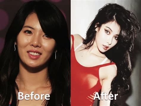 Hyuna Kpop Plastic Surgery Before And After