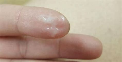 Vaginal discharge of creamy goo! Pin on vaginal health