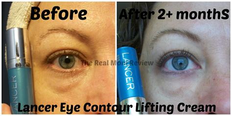 For additional information about a product, please contact the manufacturer. The Real Mom Review: Lancer Eye Cream $95 - Did It Work?