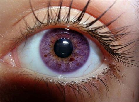 Bernsteinfarben Augen Eye Color Rare Eye Colors Eye Color Chart Rare Eyes