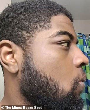 As well, people that are against minoxidil usage use that as reasoning as to why you shouldn't use it. Minoxidil Beard Reddit | Beard Style Corner