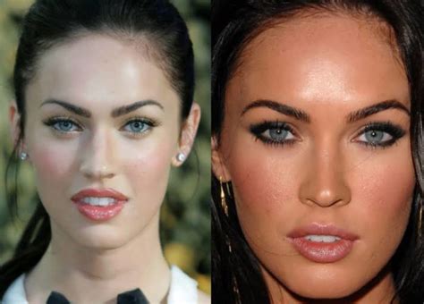 Is Megan Fox Secret In Cosmetic Surgery Verge Campus