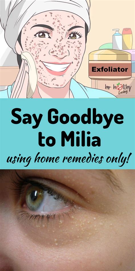 How To Remove Milia In Corner Of Eye Howotremvo