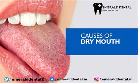 Causes Of Dry Mouth Emerald Dental