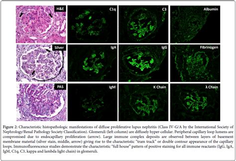 Cellular Immunology Lupus Nephritis