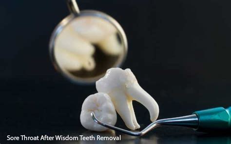 Why Sore Throat After Wisdom Teeth Removal Must Need To Know