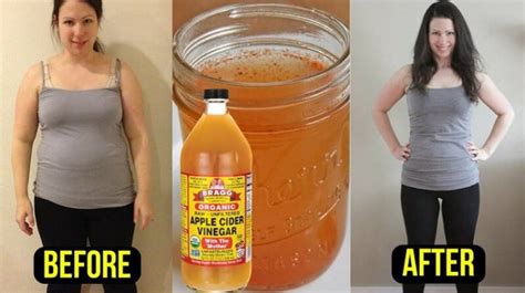 How To Use Apple Cider Vinegar For Belly Fat Ostomy Lifestyle