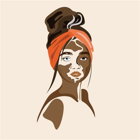 Stylish Vitiligo Woman Portrait Vector Illustration In Modern Style